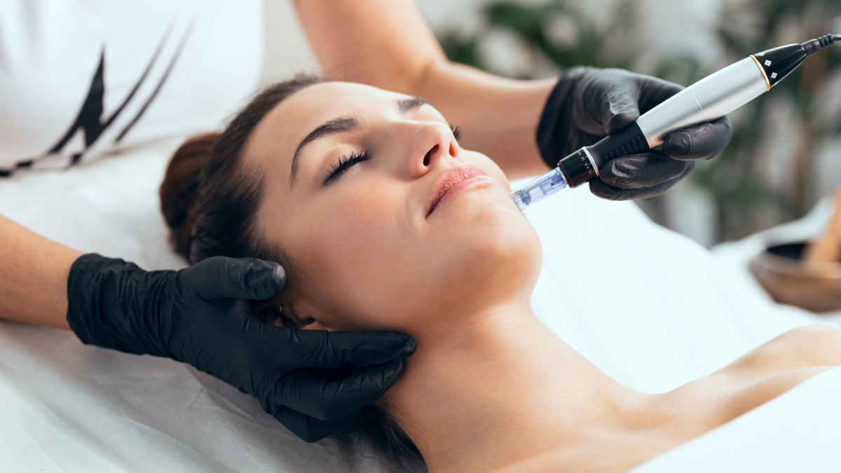 Microneedling Wellington